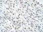SMARCD2 antibody - C-terminal region